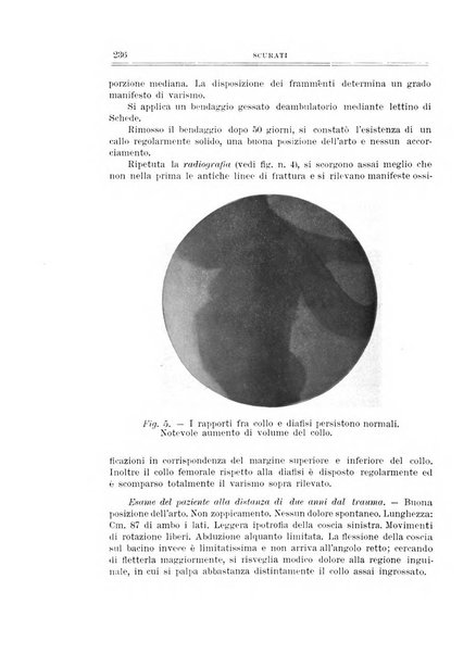 Archivio di ortopedia pubblicazione ufficiale del Pio istituto dei rachitici <1924-1950>