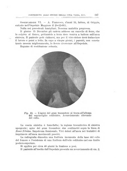 Archivio di ortopedia pubblicazione ufficiale del Pio istituto dei rachitici <1924-1950>