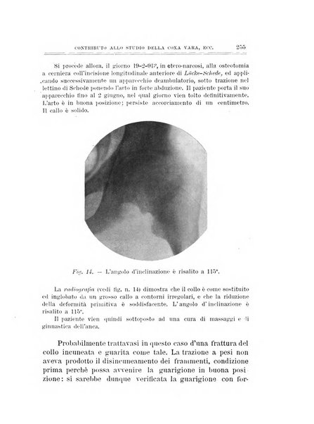 Archivio di ortopedia pubblicazione ufficiale del Pio istituto dei rachitici <1924-1950>