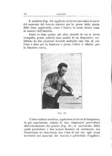 Archivio di ortopedia pubblicazione ufficiale del Pio istituto dei rachitici <1924-1950>