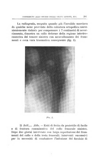 Archivio di ortopedia pubblicazione ufficiale del Pio istituto dei rachitici <1924-1950>