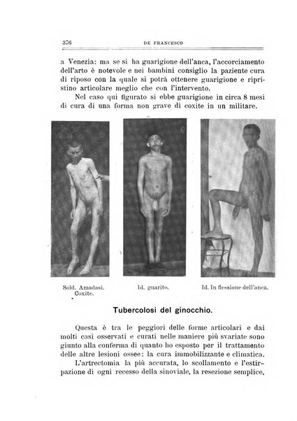 Archivio di ortopedia pubblicazione ufficiale del Pio istituto dei rachitici <1924-1950>