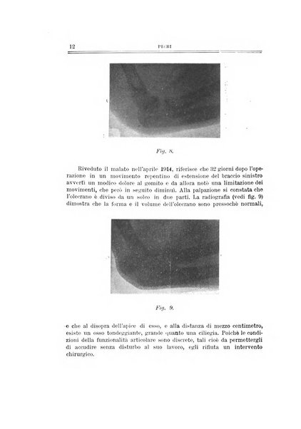 Archivio di ortopedia pubblicazione ufficiale del Pio istituto dei rachitici <1924-1950>