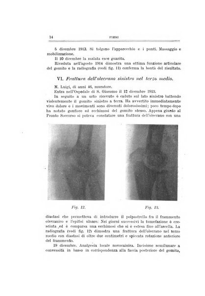 Archivio di ortopedia pubblicazione ufficiale del Pio istituto dei rachitici <1924-1950>