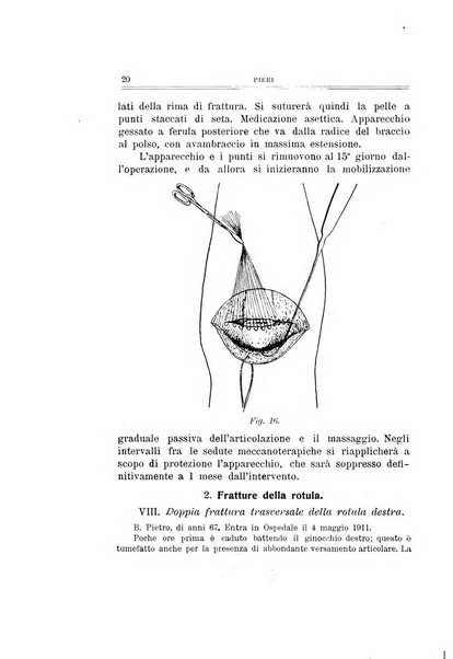 Archivio di ortopedia pubblicazione ufficiale del Pio istituto dei rachitici <1924-1950>