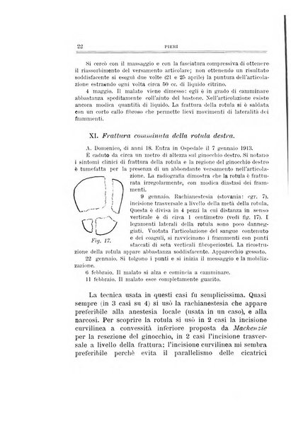 Archivio di ortopedia pubblicazione ufficiale del Pio istituto dei rachitici <1924-1950>