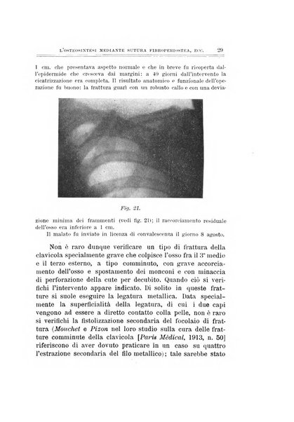 Archivio di ortopedia pubblicazione ufficiale del Pio istituto dei rachitici <1924-1950>