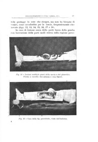 Archivio di ortopedia pubblicazione ufficiale del Pio istituto dei rachitici <1924-1950>