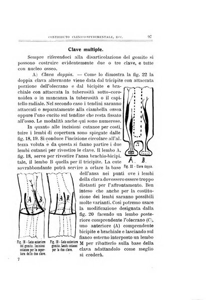 Archivio di ortopedia pubblicazione ufficiale del Pio istituto dei rachitici <1924-1950>