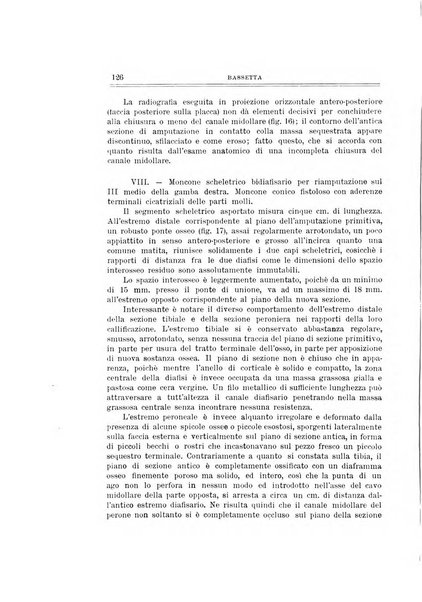 Archivio di ortopedia pubblicazione ufficiale del Pio istituto dei rachitici <1924-1950>