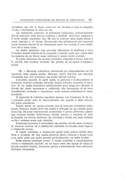 Archivio di ortopedia pubblicazione ufficiale del Pio istituto dei rachitici <1924-1950>