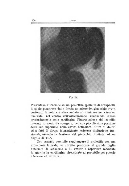 Archivio di ortopedia pubblicazione ufficiale del Pio istituto dei rachitici <1924-1950>