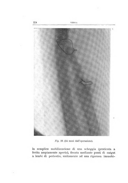 Archivio di ortopedia pubblicazione ufficiale del Pio istituto dei rachitici <1924-1950>