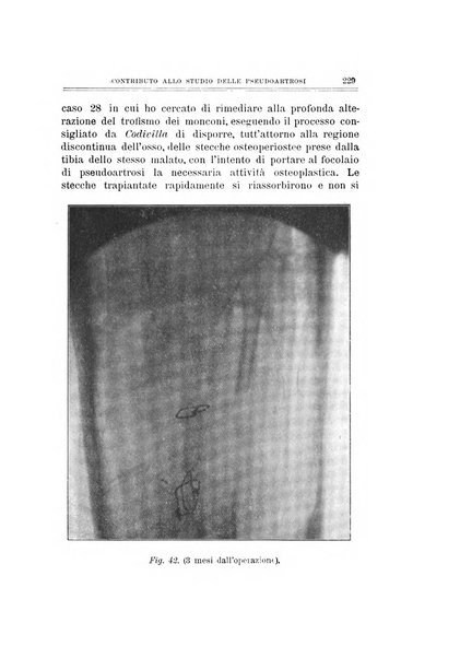 Archivio di ortopedia pubblicazione ufficiale del Pio istituto dei rachitici <1924-1950>