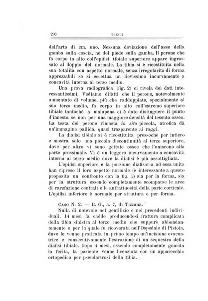 Archivio di ortopedia pubblicazione ufficiale del Pio istituto dei rachitici <1924-1950>