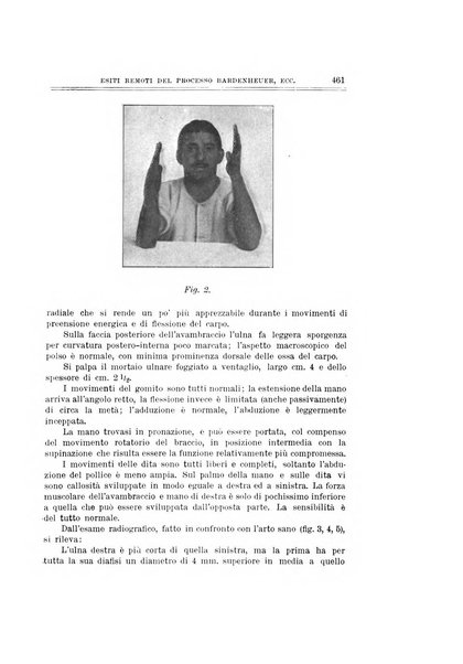 Archivio di ortopedia pubblicazione ufficiale del Pio istituto dei rachitici <1924-1950>