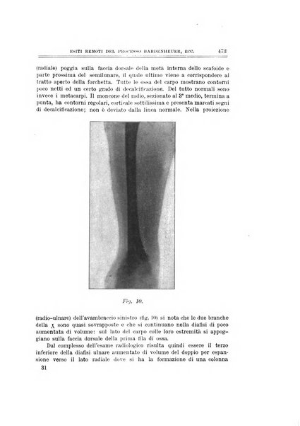 Archivio di ortopedia pubblicazione ufficiale del Pio istituto dei rachitici <1924-1950>