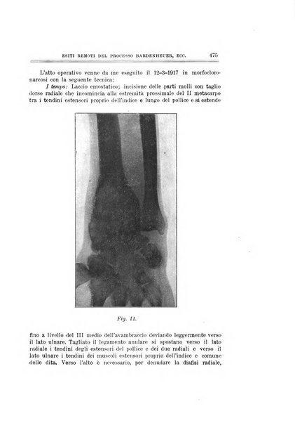 Archivio di ortopedia pubblicazione ufficiale del Pio istituto dei rachitici <1924-1950>