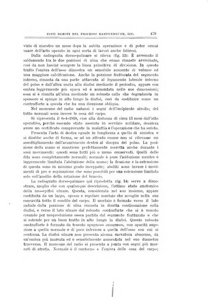 Archivio di ortopedia pubblicazione ufficiale del Pio istituto dei rachitici <1924-1950>