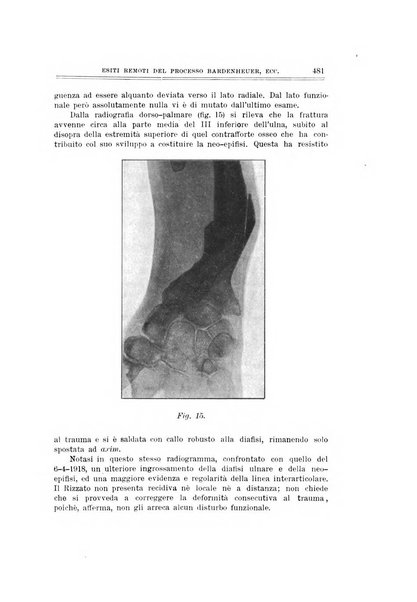 Archivio di ortopedia pubblicazione ufficiale del Pio istituto dei rachitici <1924-1950>