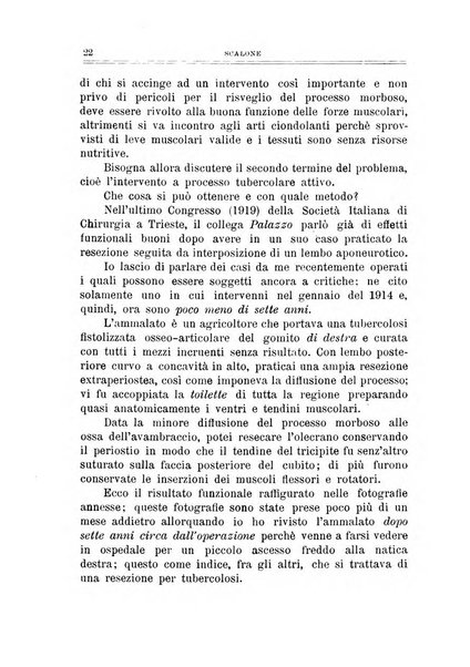 Archivio di ortopedia pubblicazione ufficiale del Pio istituto dei rachitici <1924-1950>