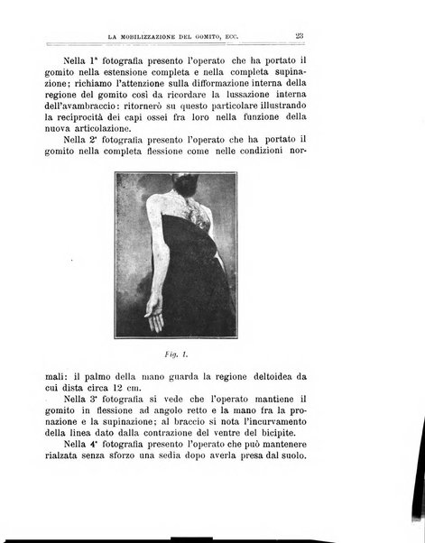 Archivio di ortopedia pubblicazione ufficiale del Pio istituto dei rachitici <1924-1950>