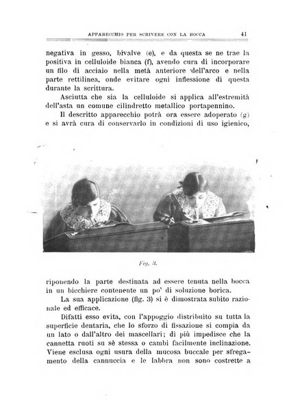 Archivio di ortopedia pubblicazione ufficiale del Pio istituto dei rachitici <1924-1950>