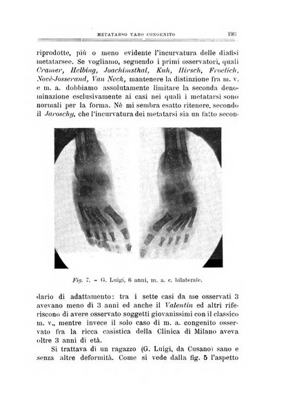 Archivio di ortopedia pubblicazione ufficiale del Pio istituto dei rachitici <1924-1950>