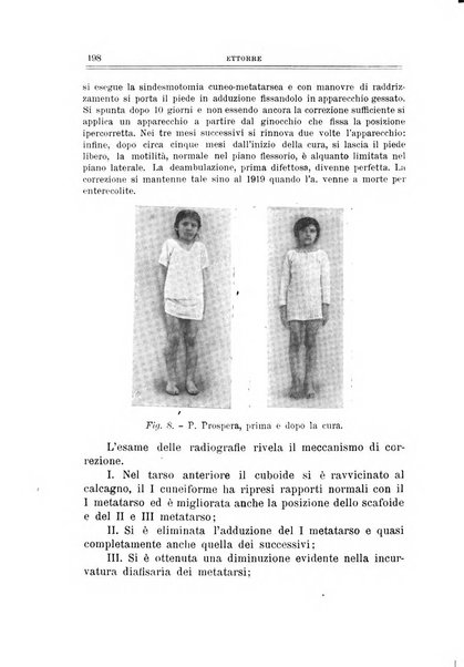 Archivio di ortopedia pubblicazione ufficiale del Pio istituto dei rachitici <1924-1950>