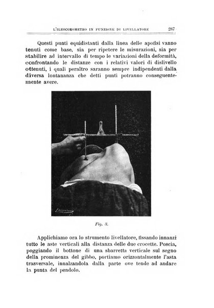 Archivio di ortopedia pubblicazione ufficiale del Pio istituto dei rachitici <1924-1950>