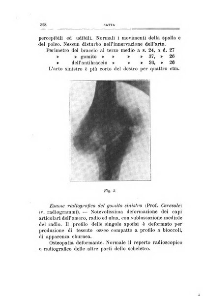 Archivio di ortopedia pubblicazione ufficiale del Pio istituto dei rachitici <1924-1950>