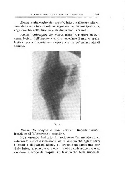 Archivio di ortopedia pubblicazione ufficiale del Pio istituto dei rachitici <1924-1950>