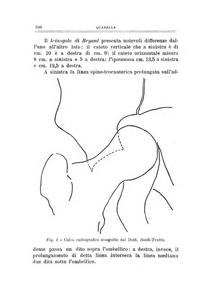 Archivio di ortopedia pubblicazione ufficiale del Pio istituto dei rachitici <1924-1950>