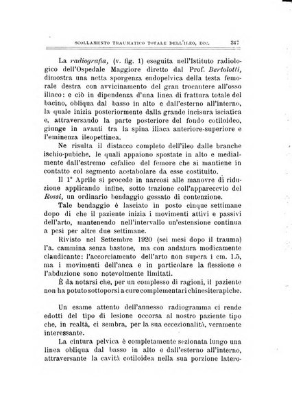 Archivio di ortopedia pubblicazione ufficiale del Pio istituto dei rachitici <1924-1950>