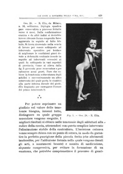 Archivio di ortopedia pubblicazione ufficiale del Pio istituto dei rachitici <1924-1950>