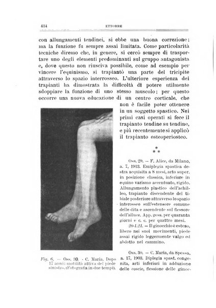 Archivio di ortopedia pubblicazione ufficiale del Pio istituto dei rachitici <1924-1950>