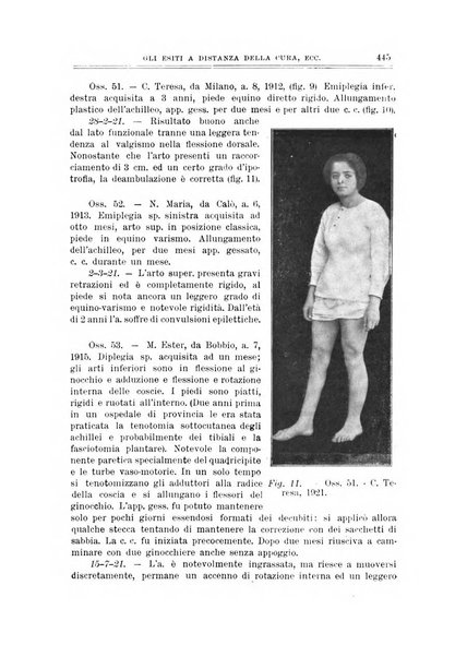 Archivio di ortopedia pubblicazione ufficiale del Pio istituto dei rachitici <1924-1950>