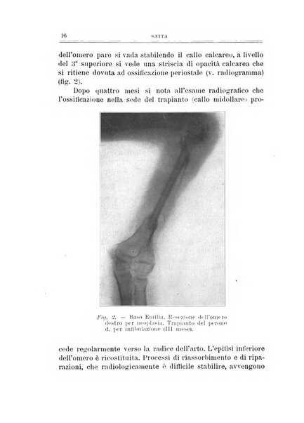 Archivio di ortopedia pubblicazione ufficiale del Pio istituto dei rachitici <1924-1950>