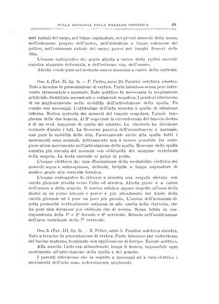 Archivio di ortopedia pubblicazione ufficiale del Pio istituto dei rachitici <1924-1950>