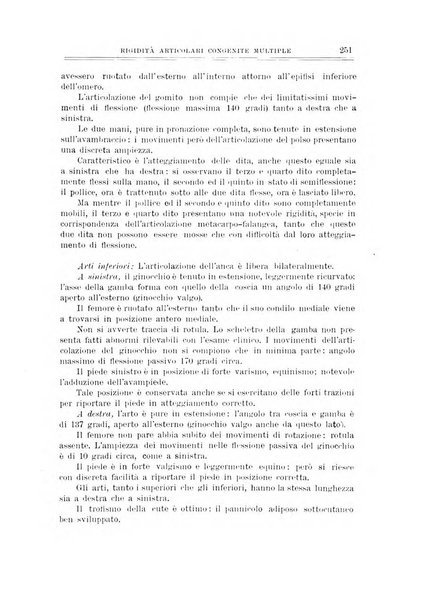 Archivio di ortopedia pubblicazione ufficiale del Pio istituto dei rachitici <1924-1950>