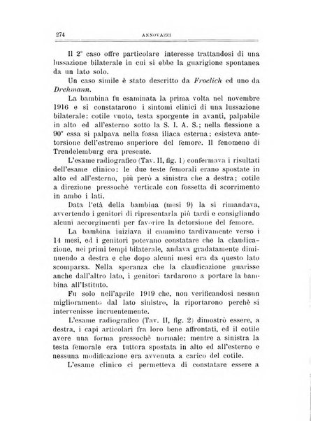 Archivio di ortopedia pubblicazione ufficiale del Pio istituto dei rachitici <1924-1950>