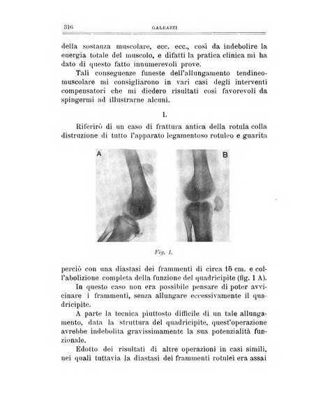 Archivio di ortopedia pubblicazione ufficiale del Pio istituto dei rachitici <1924-1950>