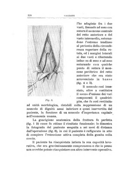 Archivio di ortopedia pubblicazione ufficiale del Pio istituto dei rachitici <1924-1950>