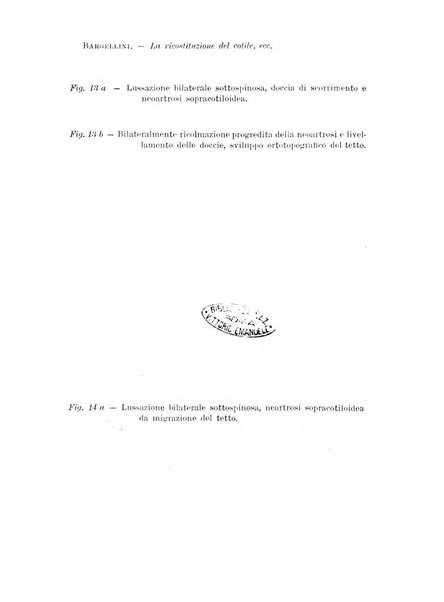 Archivio di ortopedia pubblicazione ufficiale del Pio istituto dei rachitici <1924-1950>