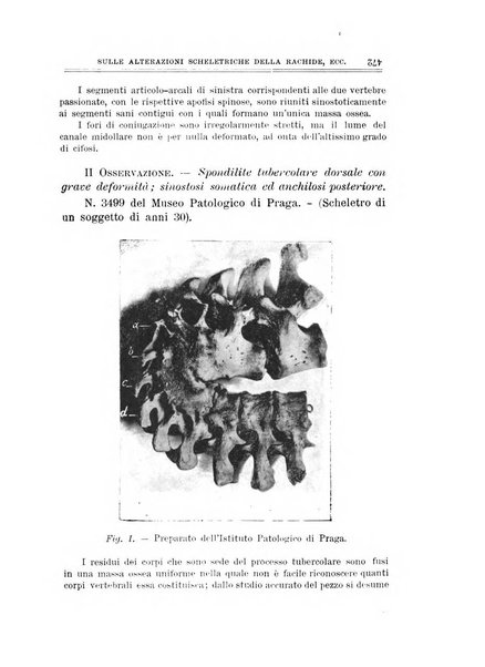 Archivio di ortopedia pubblicazione ufficiale del Pio istituto dei rachitici <1924-1950>