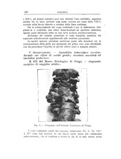 Archivio di ortopedia pubblicazione ufficiale del Pio istituto dei rachitici <1924-1950>