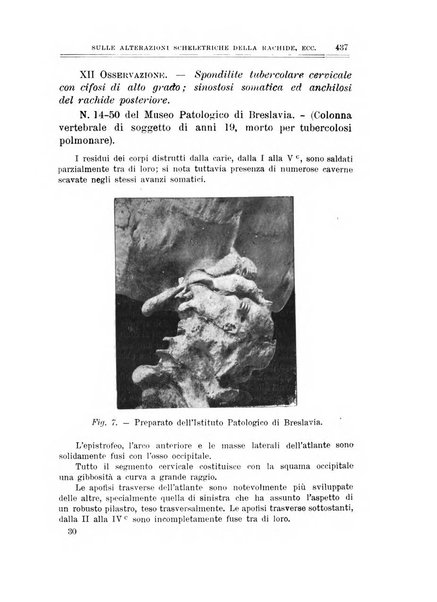 Archivio di ortopedia pubblicazione ufficiale del Pio istituto dei rachitici <1924-1950>