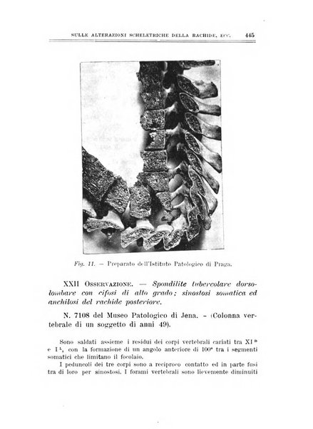 Archivio di ortopedia pubblicazione ufficiale del Pio istituto dei rachitici <1924-1950>