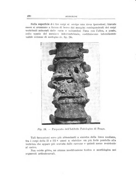 Archivio di ortopedia pubblicazione ufficiale del Pio istituto dei rachitici <1924-1950>