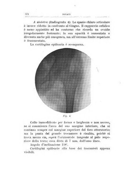 Archivio di ortopedia pubblicazione ufficiale del Pio istituto dei rachitici <1924-1950>